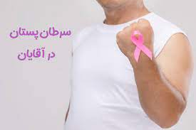 مردان هم به سرطان زنانه مبتلا می‌شوند!